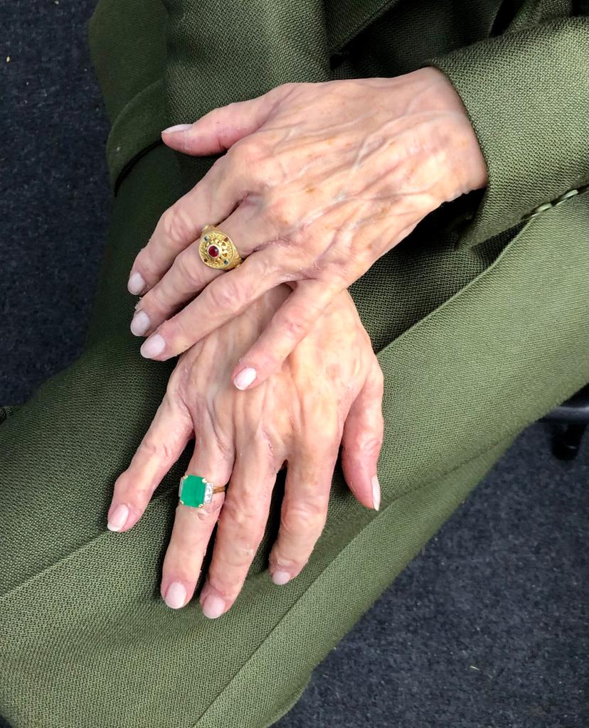 Two elderly hands—each adorned with a characterful ring—rest on a lap clothed in green fabric. The lighting reveals the skins texture, while neatly trimmed nails add to the portrait’s quiet character.