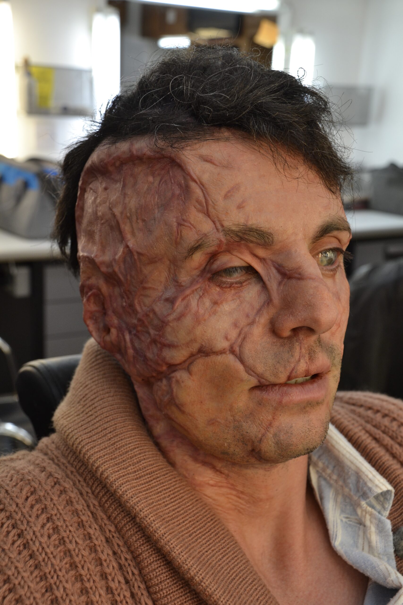 A character with realistic special effects makeup appears to have severe facial scarring and burns on the left side of their face, sitting indoors and wearing a brown sweater and a blue shirt.