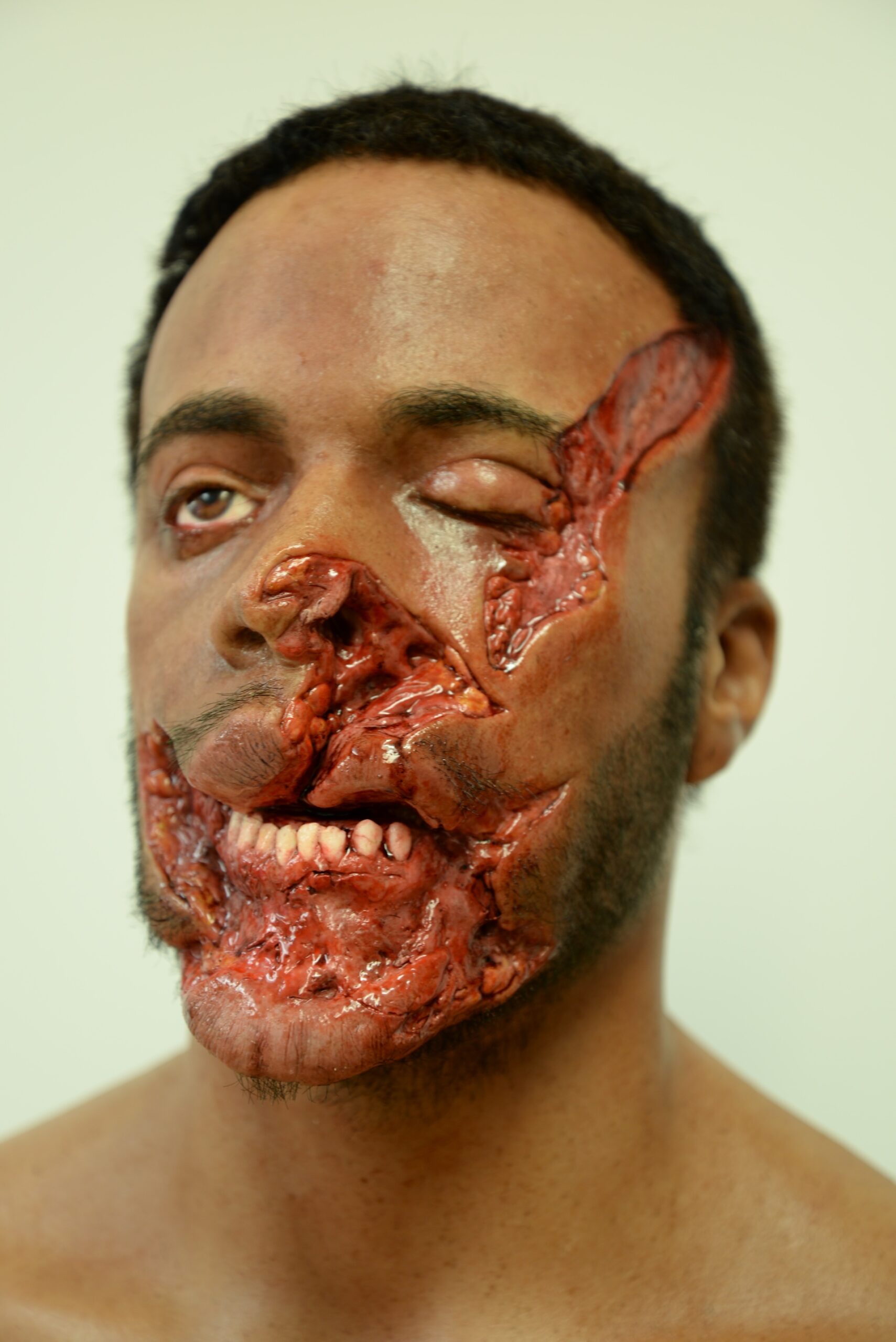 A man with realistic special effects makeup inspired by Bodies, showing severe facial injuries—exposed teeth, damaged nose, and one eye swollen shut—against a plain light-colored background.