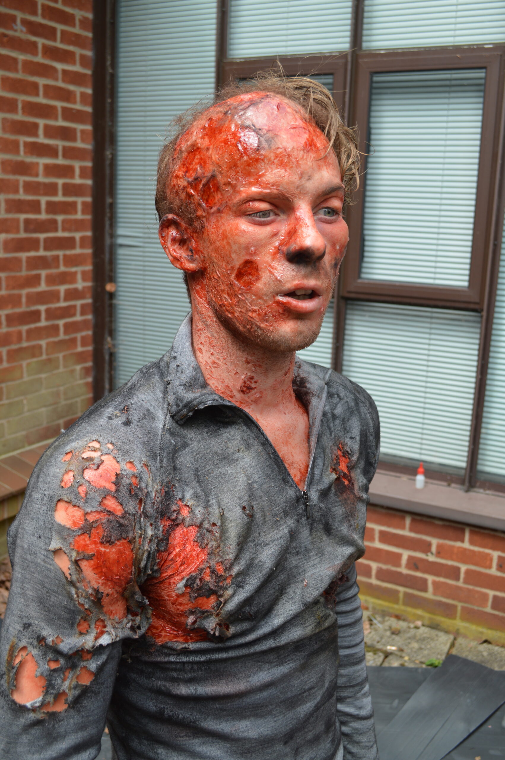 A person with realistic special effects makeup appears to have severe medical trauma, with burns and injuries on their face and upper body, wearing a tattered, blood-stained shirt, standing outside near a brick wall and window.