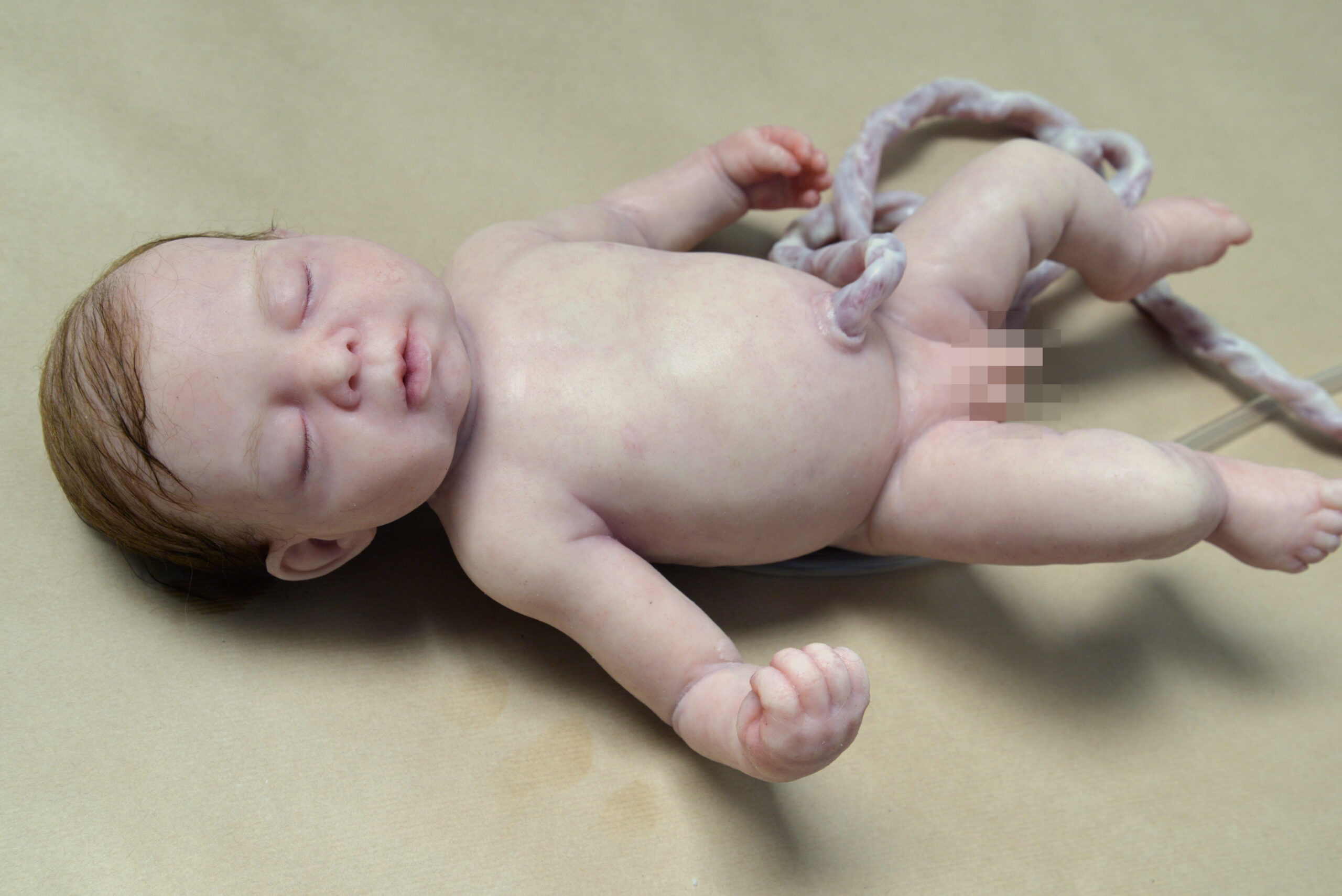A newborn baby with a visible umbilical cord lies on a beige surface. The babys bodies are carefully positioned, and the genital area is pixelated for privacy.