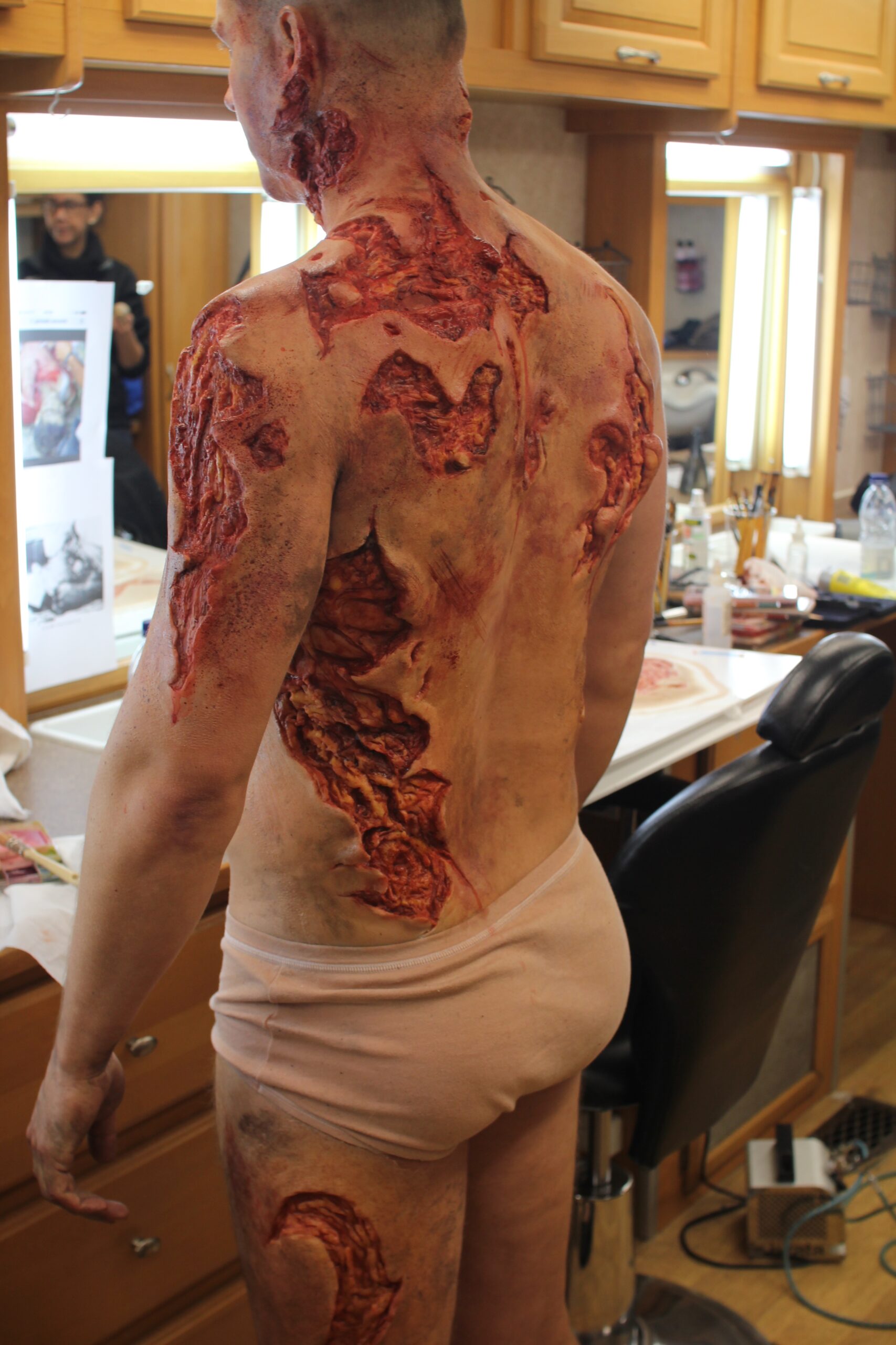 A person in a makeup room stands with their back to the camera, covered in realistic special effects makeup that simulates severe, bloody burn wounds—evoking the aftermath of trauma or a serious medical emergency—on their back, arm, and leg.